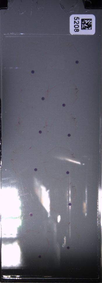 Media type: image; Special Collections 4011   shows specimen_part histological serial section;